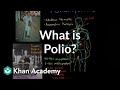 Understanding Polio and Its Effects