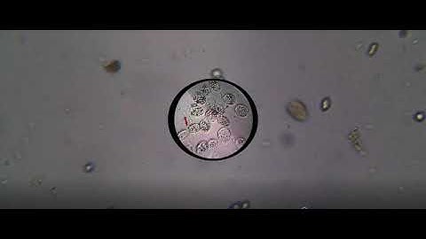 LA VITA MICROSCOPICA IN UNA GOCCIA DI  ACQUA DI POZZA.
