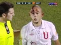 Jogador tem rosto pisoteado Newell's Old Boys x LDU Copa Sulamericana 02/11/2010