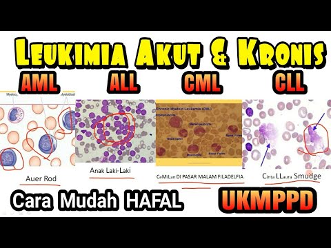 Leukimia Akut & Kronik AML, ALL, CML, CLL, Gambaran Khas Cara Mudah Menghafal UKMPPD Hematoimunologi