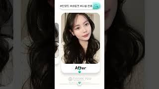 인모드+슈링크 전후 차이 보여드립니다 #피부관리 #피부시술 #전후사진 #비포애프터 #shorts