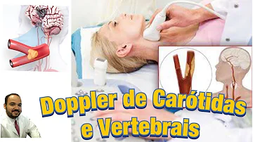 Como é feito o exame na carótida?