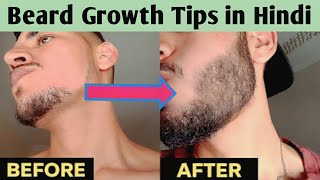 Beard Growth Tips | How to grow Beard faster Naturally