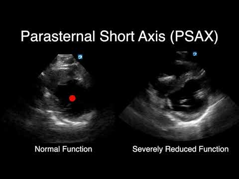 POCUS - Visually