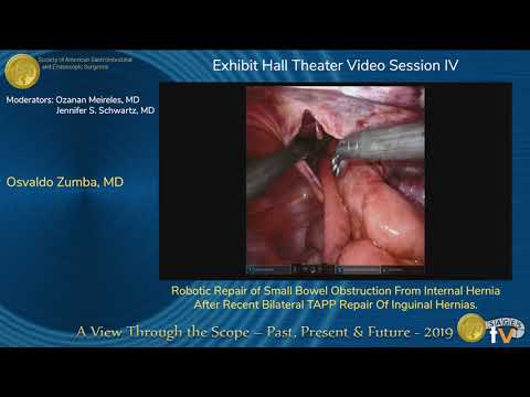 Robotic Repair of Small Bowel Obstruction From Internal Hernia After...