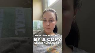 Is hCG higher with Down Syndrome?