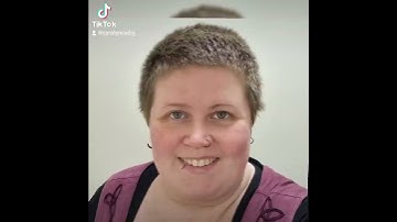 1 year hair growth timelapse