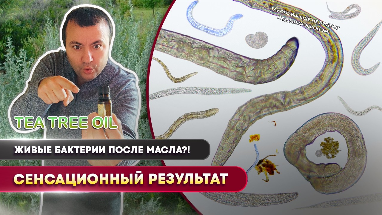 Что делает эфирное масло чайного дерева с бактериями? Реальный эксперимент под микроскопом