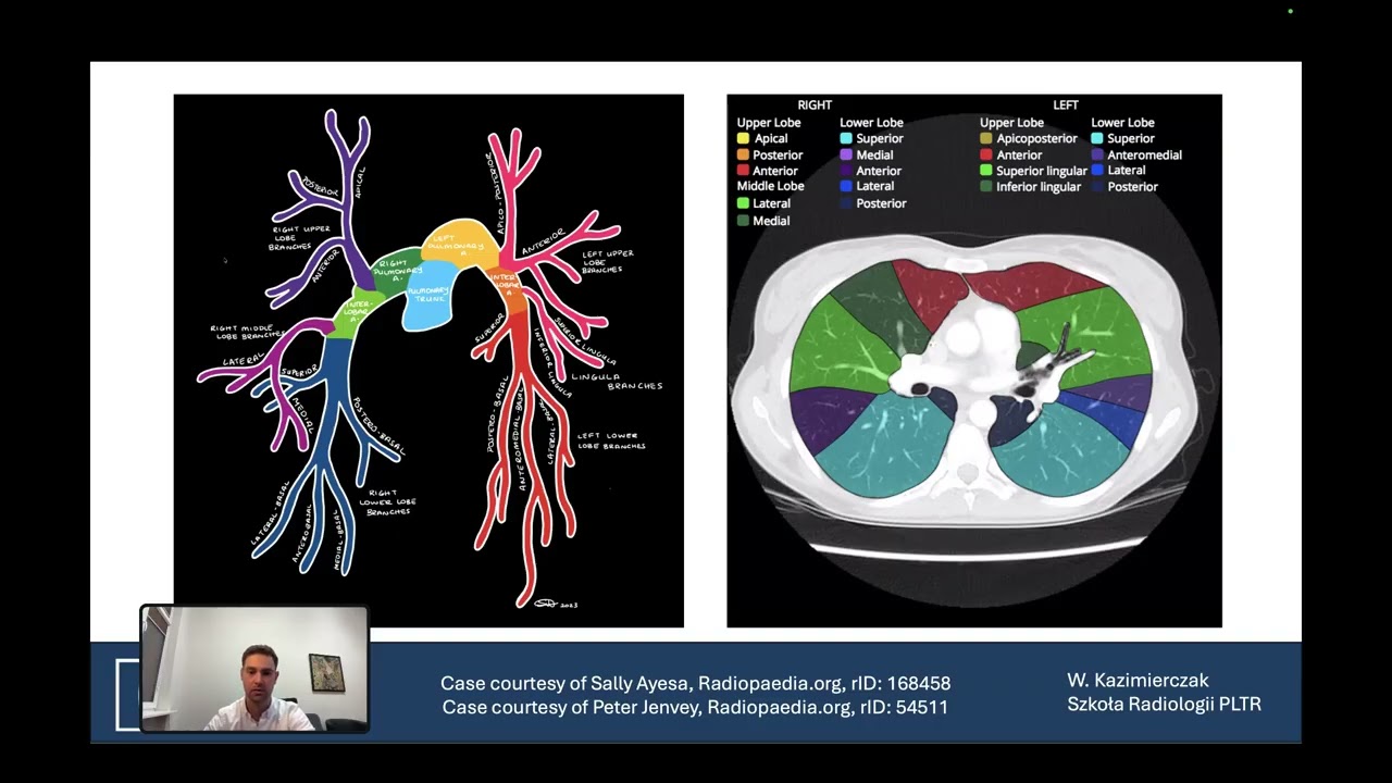 W. Kazimierczak - Angio-TK w diagnostyce zatorowości płucnej – tips and tricks.