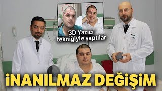 3D Yazıcı Tekniğiyle Kafasına Titanyum Parça Takılan Hastanın İnanılmaz Değişimi