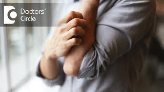 How to manage rashes with severe itching all over the body? - Dr. Sachith Abraham