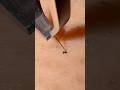 #plucking #satisfying #tweezers #blackheads #pimple #skincare #hairremoval #extraction #ingrownhair
