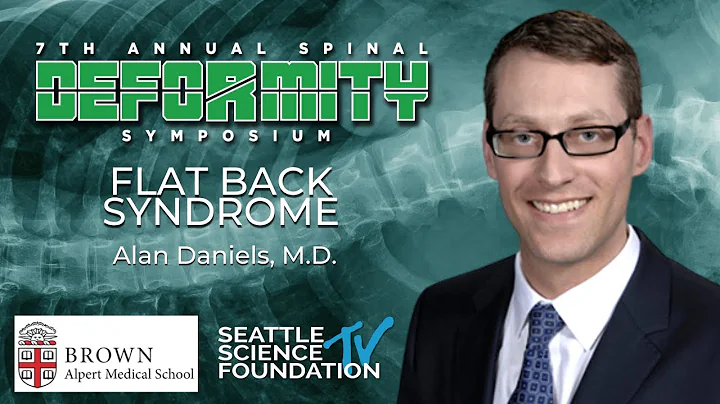 Flat Back Syndrome - Alan Daniels, M.D.