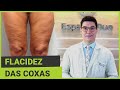 Flacidez das Coxas