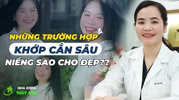 NHẬN BIẾT & ẢNH HƯỞNG CỦA KHỚP CẮN SÂU ĐẾN HÀM RĂNG NHƯ THẾ NÀO