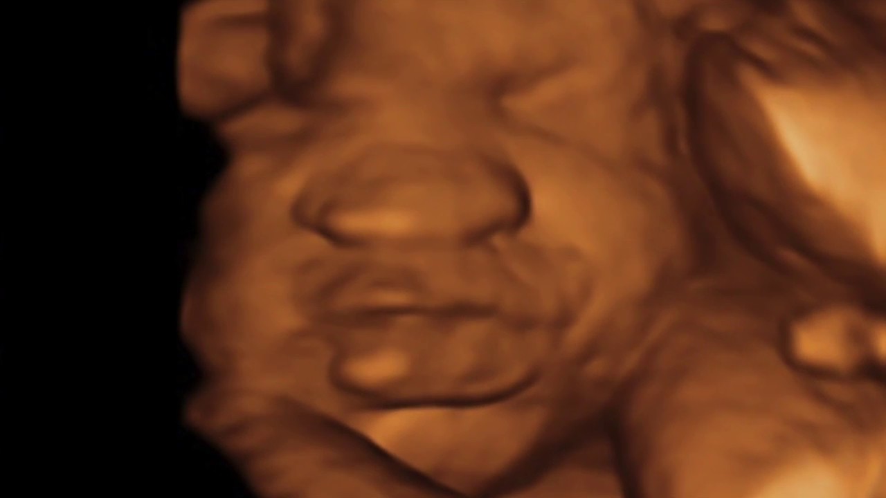3D SONOGRAM EXPERIENCE | VLOG - YouTube