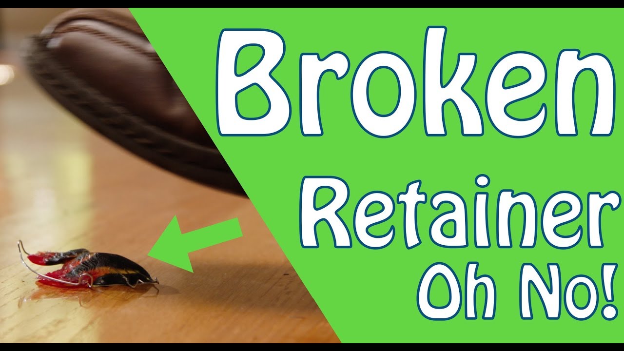 My Retainers Broke Should I Replace My Broken Retainers? YouTube