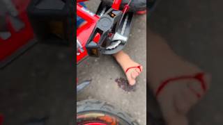 Abil Fell And His Leg Bled  shorts short