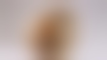 Utilization of 3D Printed Heart Model to Tailor Patch During Surgical Ventricular Restoration