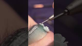 Liftingde Kirpiğin Hazır Olup Olmadığını Nasıl Anlarız?