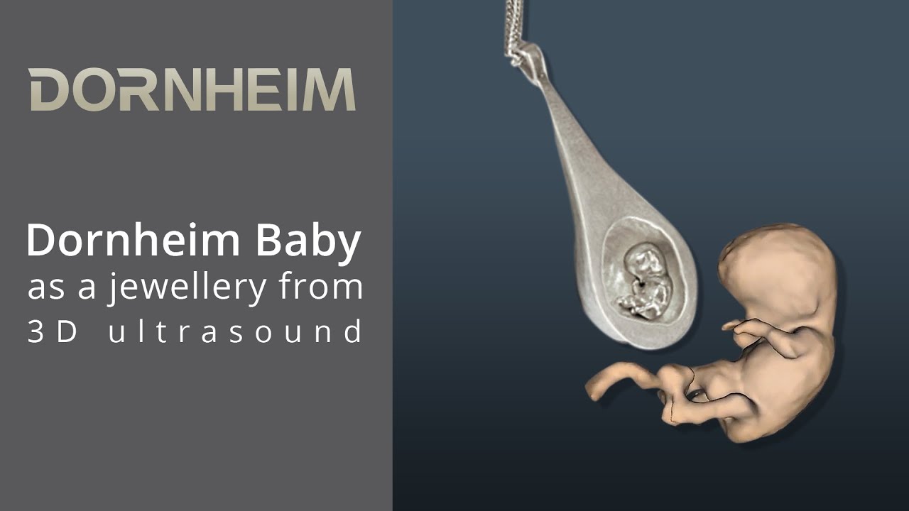 Dornheim Baby as jewellery from 3D ultrasound