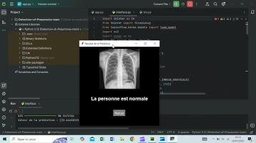 Experience the Future of Medical Imaging: AI Detects Pneumonia Effortlessly 🩺👨‍⚕️