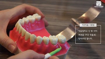 [더와이즈치과병원] 치간 칫솔 사용법