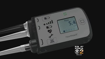 New Generation Of Heart Pumps Gives Life To AGH Patients