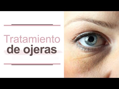 Tratamiento para las  ojeras l Dra. María Clara Mejía