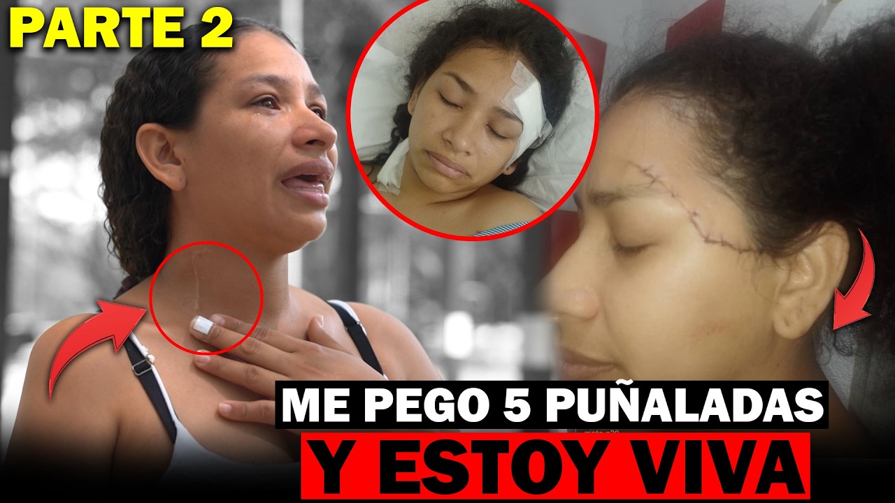 PARTE FINAL - Caso de Yamile, su propia pareja le propino 5 puñaladas 😨 Pero ella quedo con vida