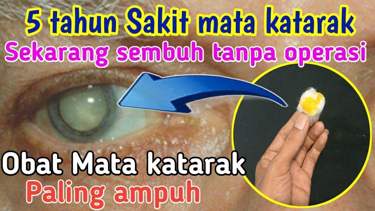 Obat Mata Katarak Mata Katarak Sembuh Tanpa Operasi Cara Mengobati Mata Katarak Youtube