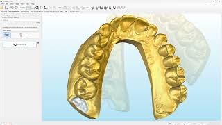 GDSW Automatic Tooth Segmentation