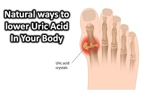 How To Lower Uric Acid In Your Body.
