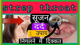 strep throat का सिर्फ 1 उपाय!!गले मे दर्द,सूजन,निगलने में दिक्कत बच्चो से लेकर बड़ो तक सिर्फ 1 उपाय