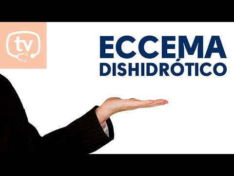 Vídeo: Eccema Dishidrótico En Los Dedos: Síntomas Y Tratamiento