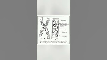 Thallus structure of spirogyra