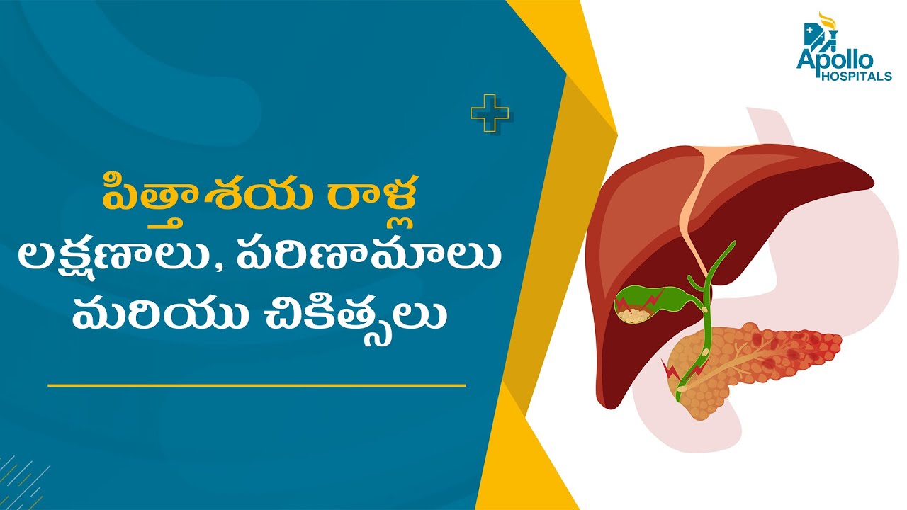 పిత్తాశయ రాళ్ల లక్షణాలు, పరిణామాలు మరియు చికిత్సలు | Gallbladder Stones Symptoms, and Treatments