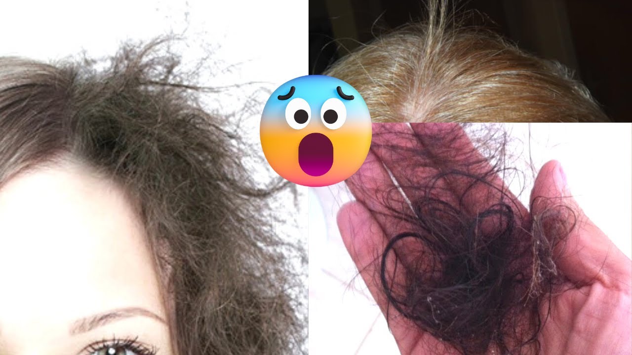 CABELO CAINDO SÓ DE PASSAR A MÃO: USE ISSO PARA TRATAR #HairTutorial ...
