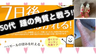 [踵の角質を削らない]❣️ケア❣️ 50代でも綺麗になるか！