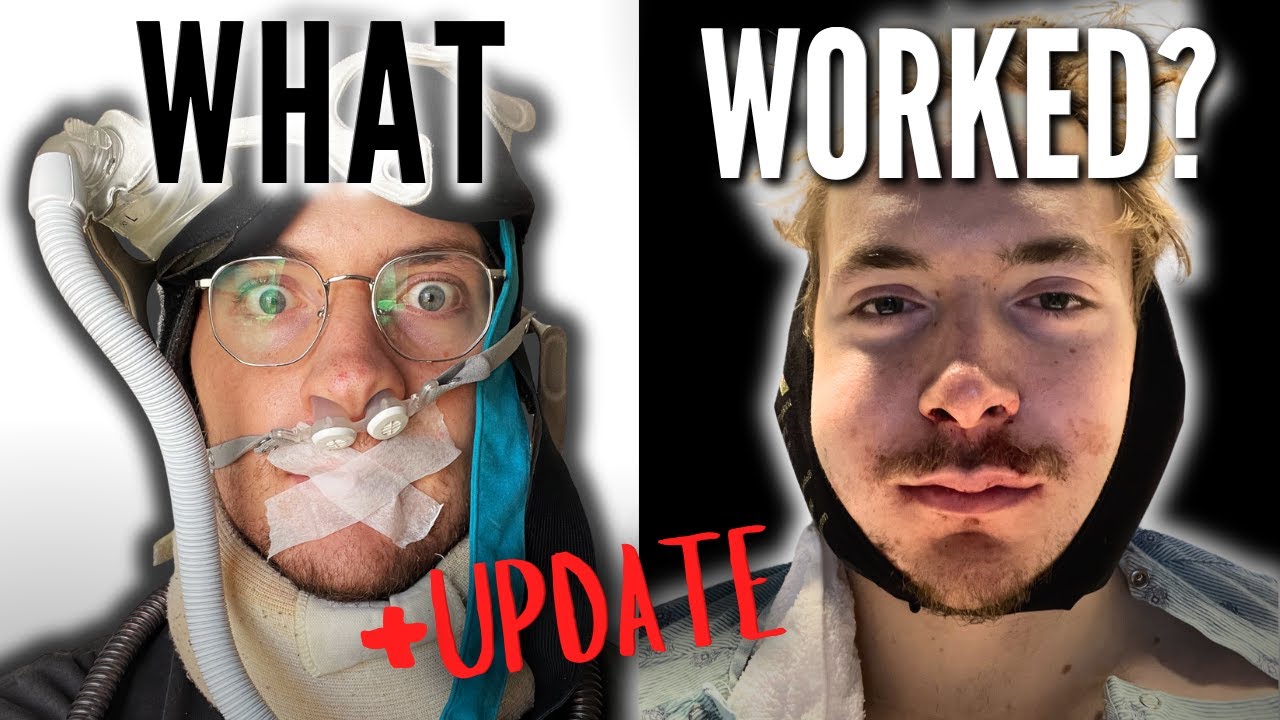 I Spent $100,000 on New Sleep Apnea Treatments