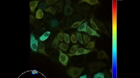 Time-lapse of HeLa cells with the Toggel FLIM camera