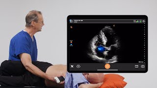 Color Doppler for Tricuspid Regurgitation