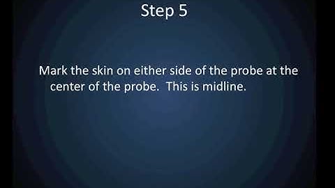 Ultrasound guided lumbar puncture/ Must see