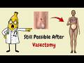Before You Get a Vasectomy… Watch This First