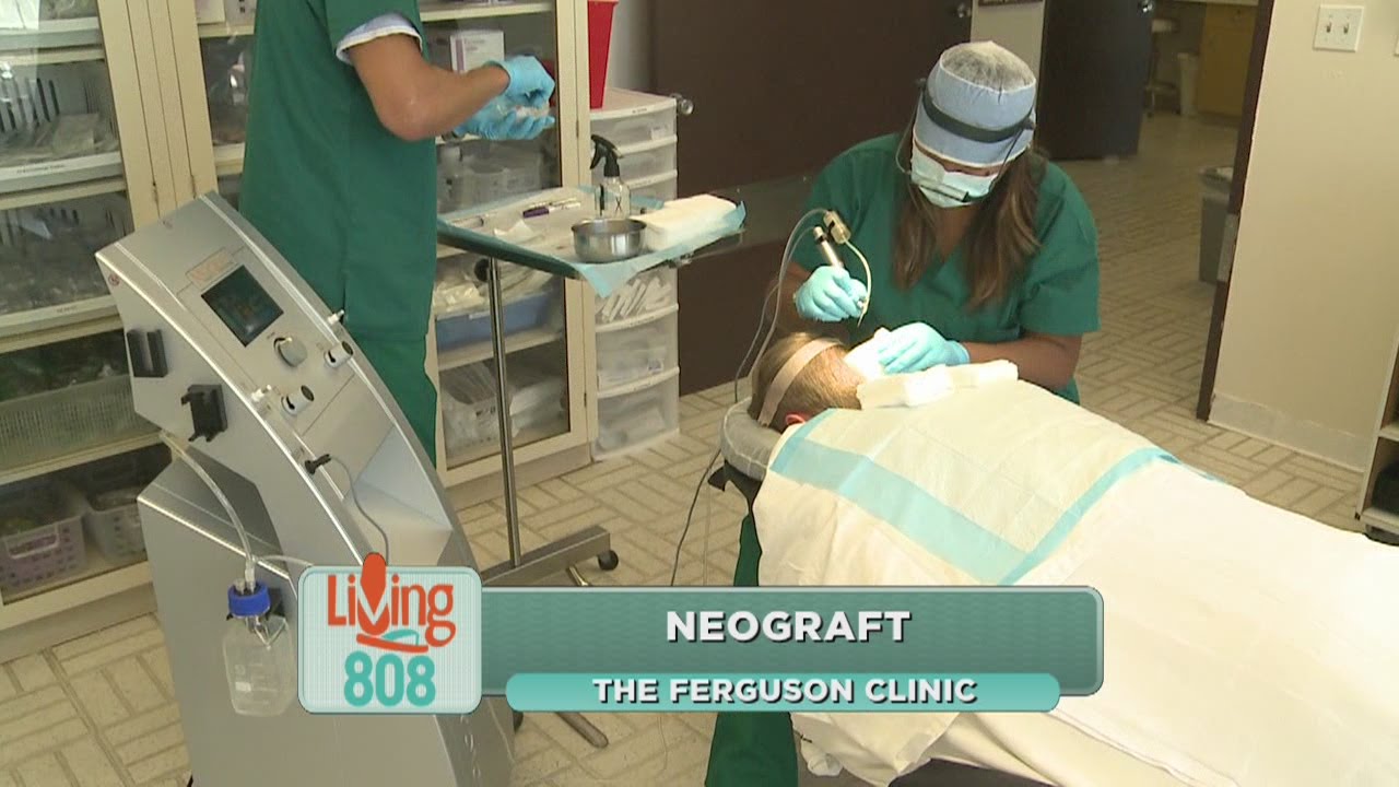 A new breakthrough for hair loss patients YouTube