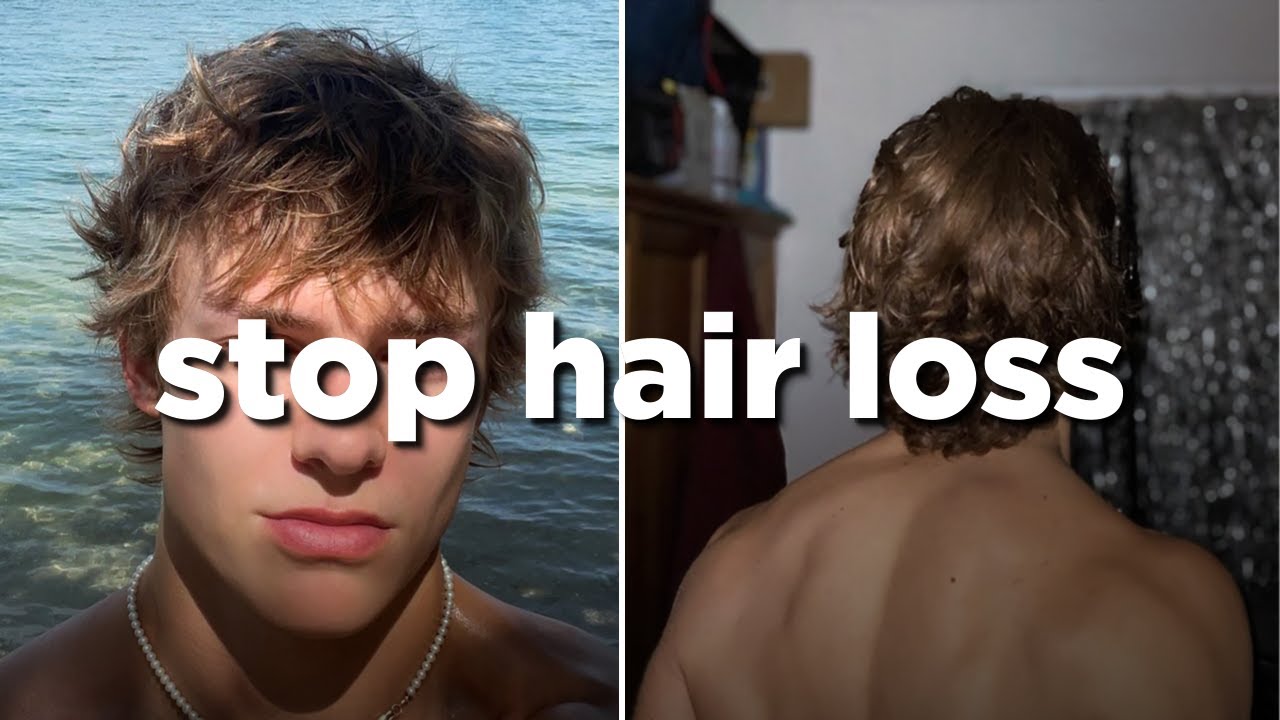 How to ACTUALLY stop hair loss as a guy