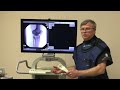 How to Use a C-arm - Subtraction