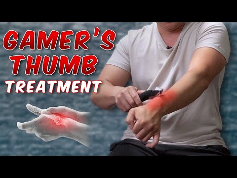 De Quervain’s Syndrome Treatment | Mommy's Thumb / Gamer's Thumb | Physical Therapist