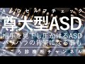 尊大型ASD【発達障害ASDに自己愛性パーソナリティ障害合併、精神科医が13分で説明】