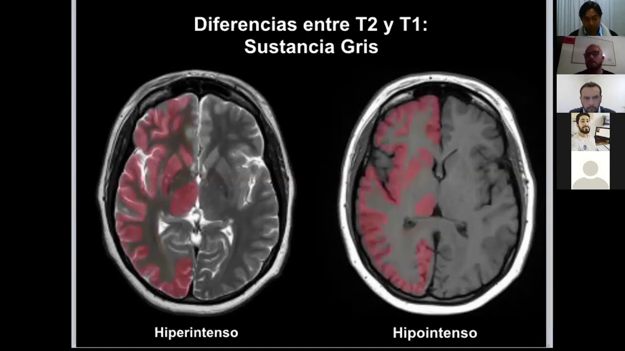 Para que sirve el contraste en una resonancia